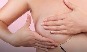 foto65462